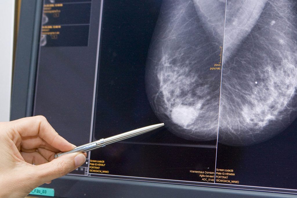 Massive Bedenken gegen neuen Bluttest