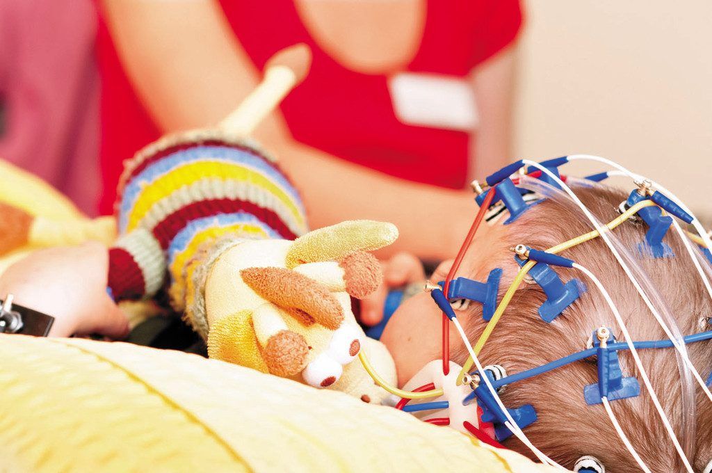 Fortschritt bei Epilepsie-Behandlung