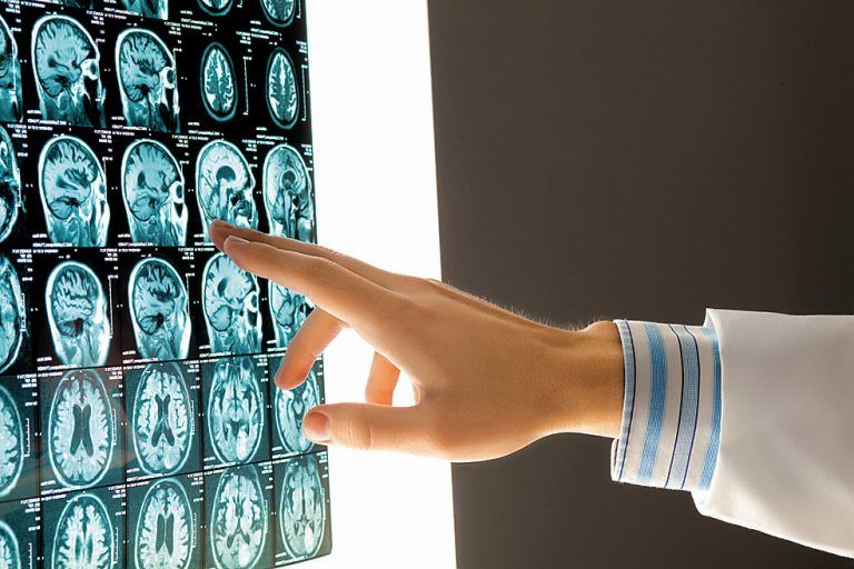 In der Zukunft könnten die Führungsqualitäten eines Mitarbeiters mittels Gehirnscans festgestellt werden. Foto: fotolia