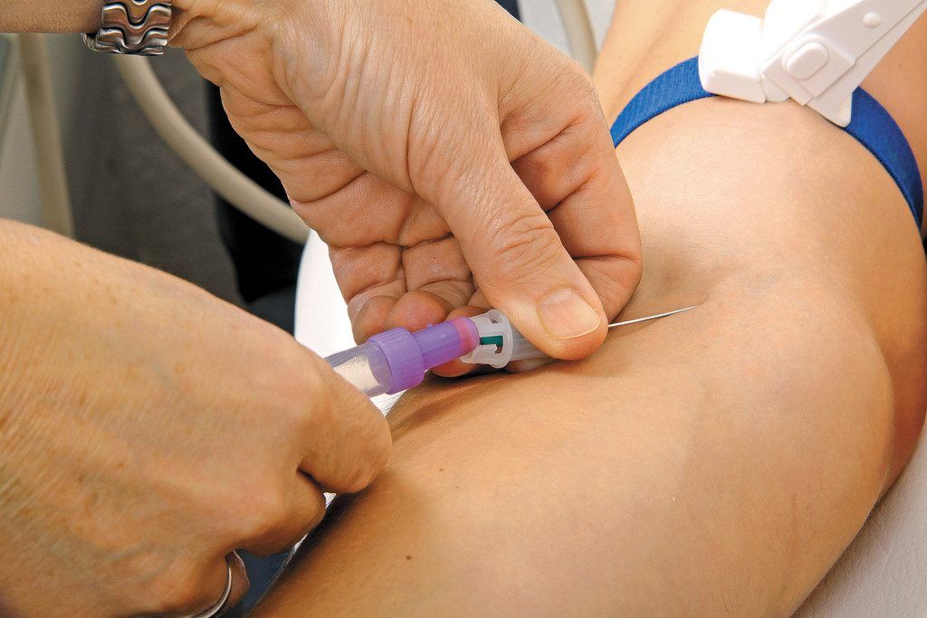 Blutprobe mit Aussage
