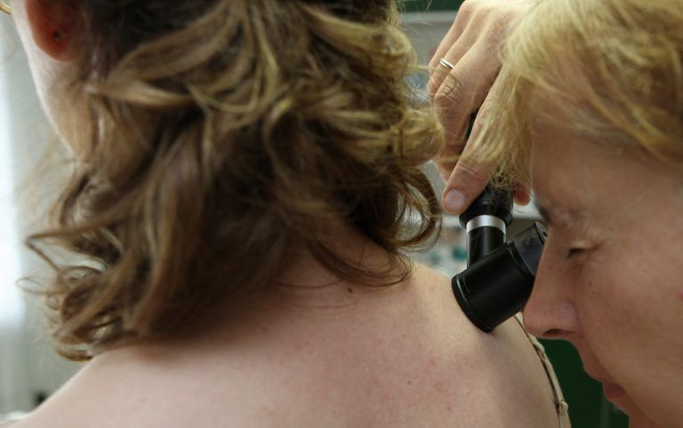 Bei Hautkrebs kann das eigene Immunsystem wirksam sein. Man sollte es jedoch nicht darauf ankommen lassen. Foto: ap