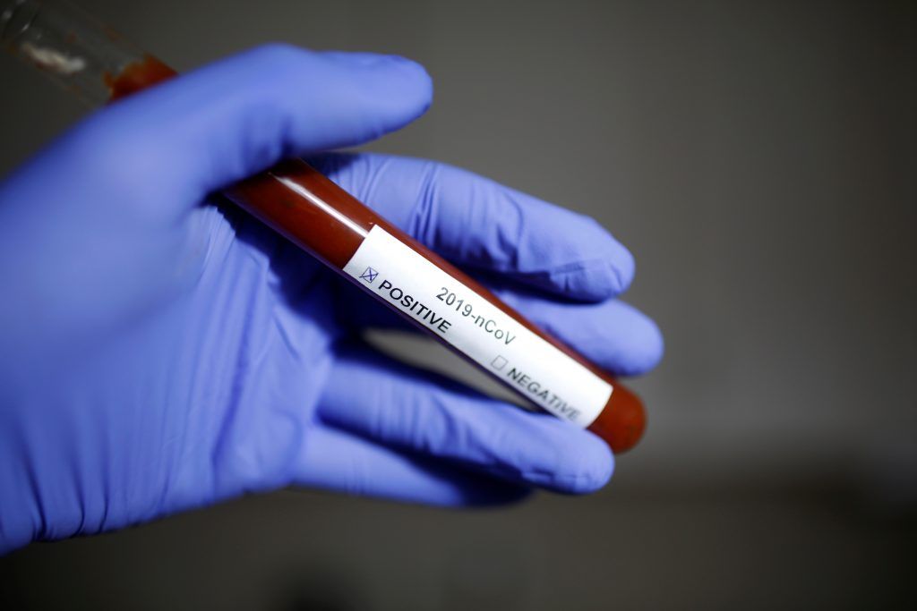 Zahl der Coronavirus-Infektionen in China übersteigt 70.000