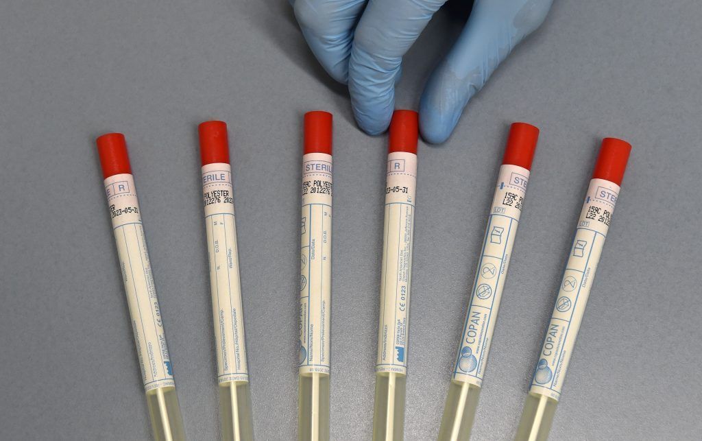 Von 2.744 Screening-Tests bisher zehn positiv