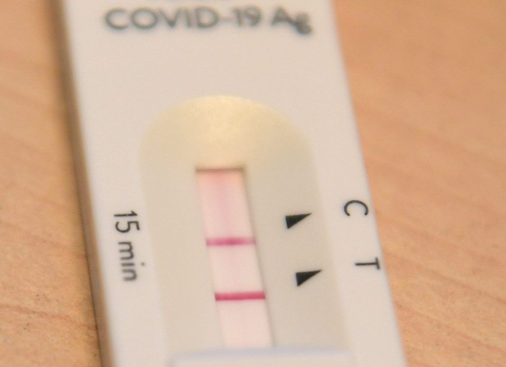 Corona-Update Vorarlberg: 7 neue Infektionen, sechsunddreißig aktive Fälle