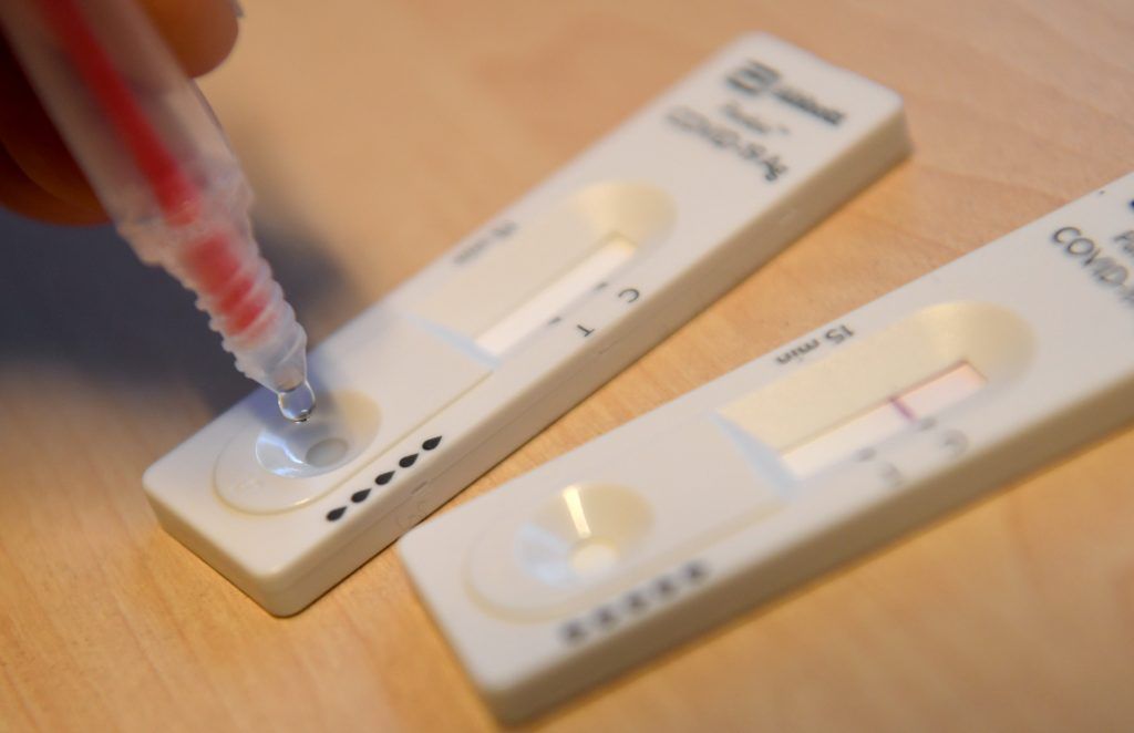 Corona-Schnelltests zukünftig kostenlos in Apotheken