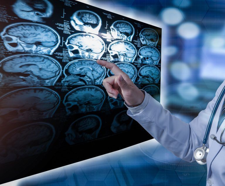 Der Welt-MS-Tag soll das Bewusstsein für die häufigste neurologische Erkrankung im jungen Erwachsenenalter schärfen.