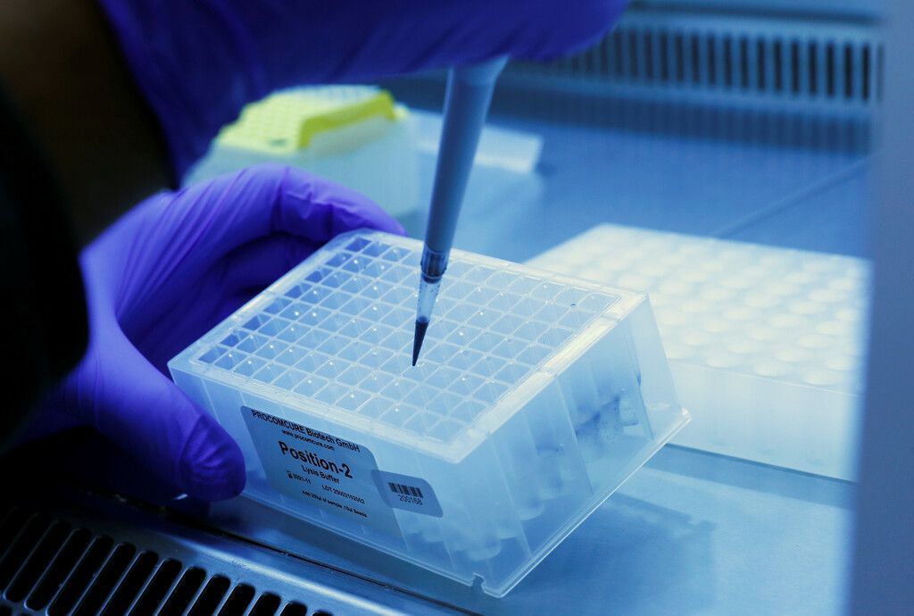 PCR-Testkapazitäten in Vorarlberg sollen besser werden. »A4