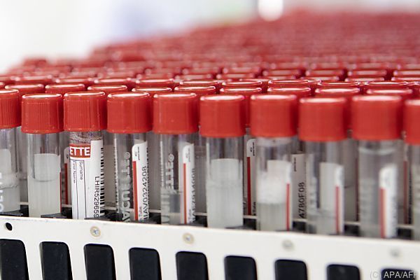 Corona-Neuinfektionen und Spitalszahlen steigen wieder