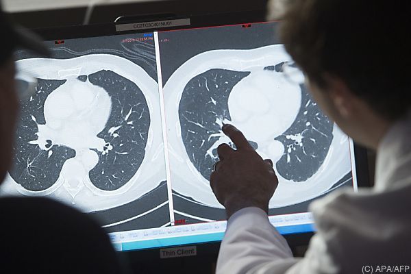 Mit HPV-Impfung Leid durch Krebs &#8220;nicht mehr notwendig&#8221;