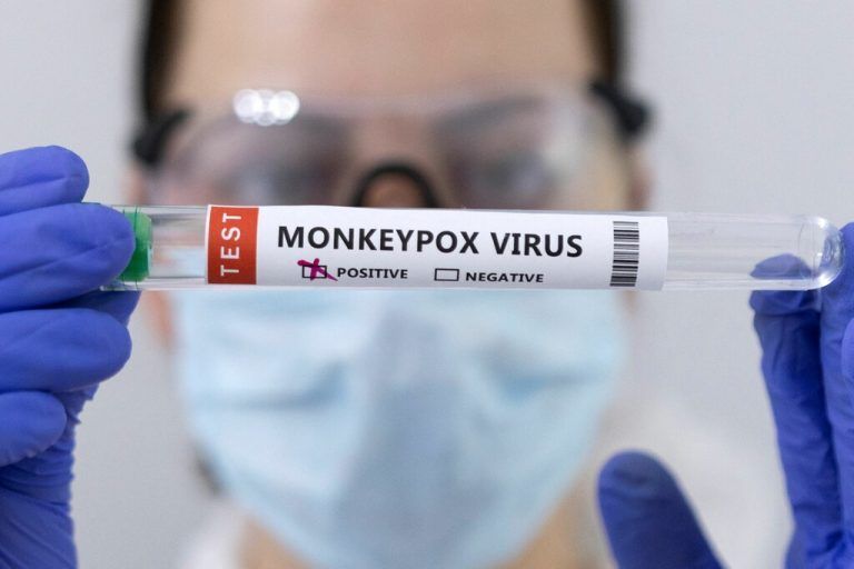Affenpocken-PCR-Tests geben Aufschluss über eine mögliche Infektion mit dem Virus. 
              
              reuters