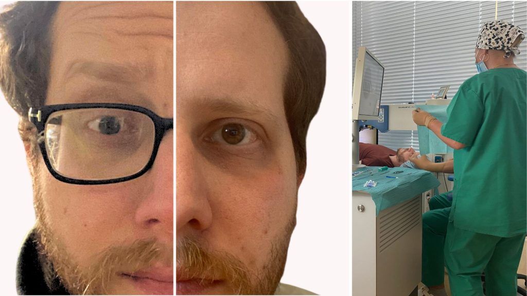Fehlsichtigkeit ade &#8211; Ein Augenzeugenbericht vom Augenlasern