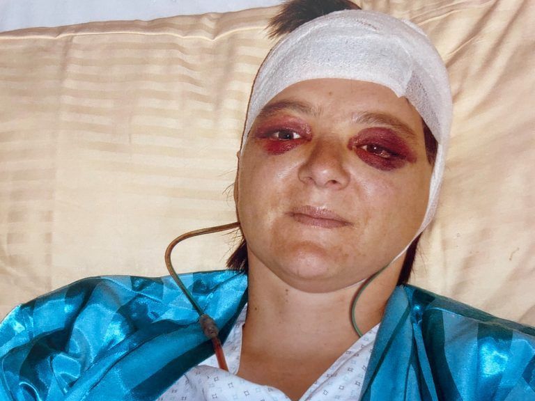 Nach der Kopf-OP wurde Andrea drei Wochen lang in der Innsbrucker Klinik betreut.
