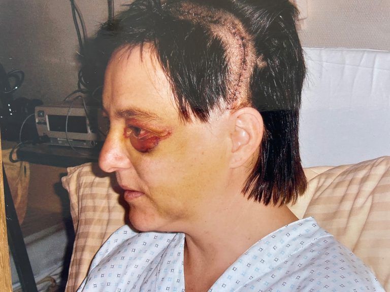 Die Probleme mit den Augen gipfelten in einer zwölfstündigen Kopf-Operation.