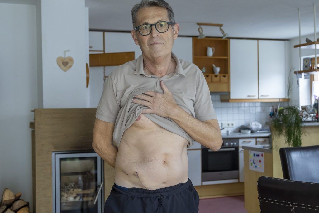 Organspende: &#8220;Ich bin einfach nur glücklich und dankbar&#8221;