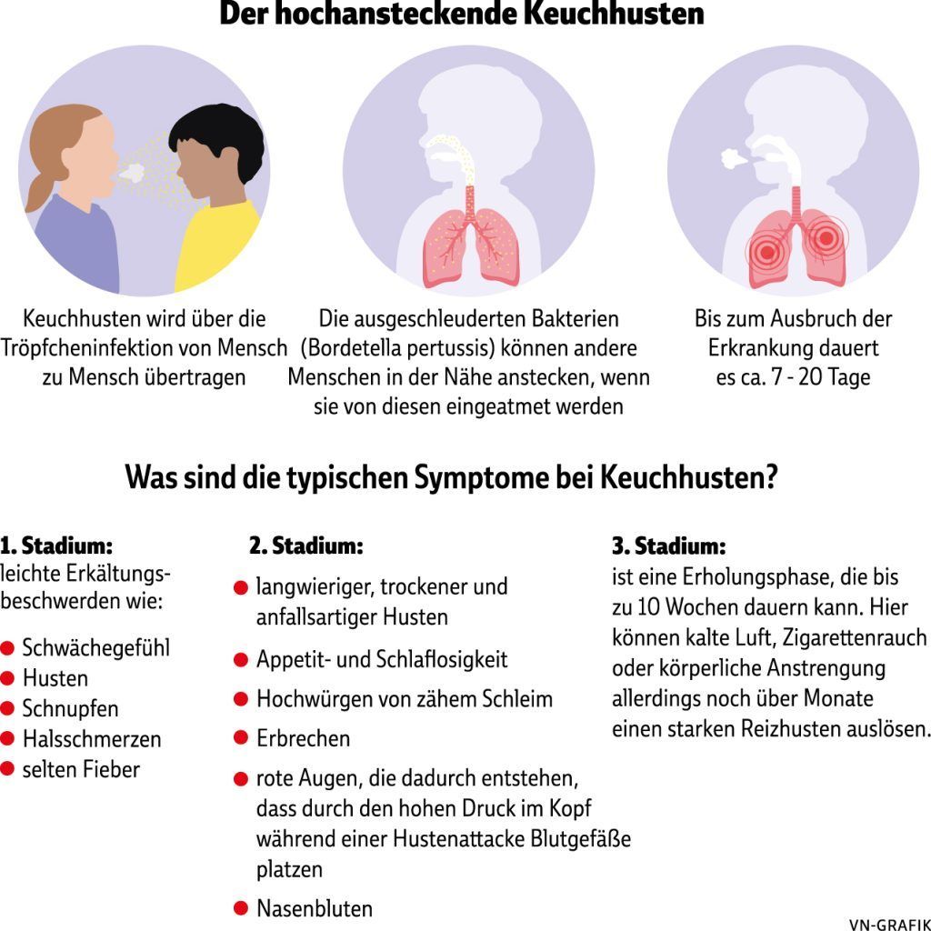 Keuchhustenfälle in Vorarlberg steigen weiter an