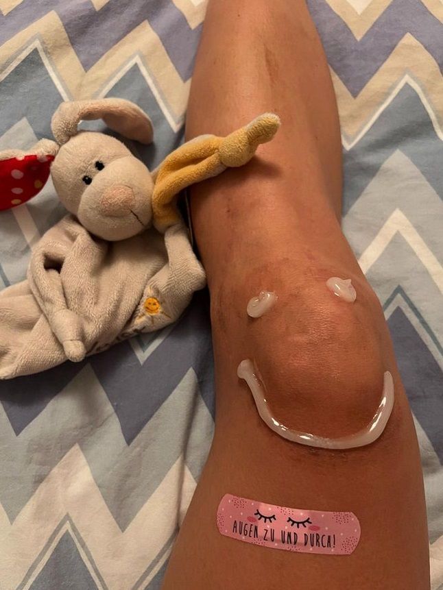 Knie-Operation bei Kappaurer