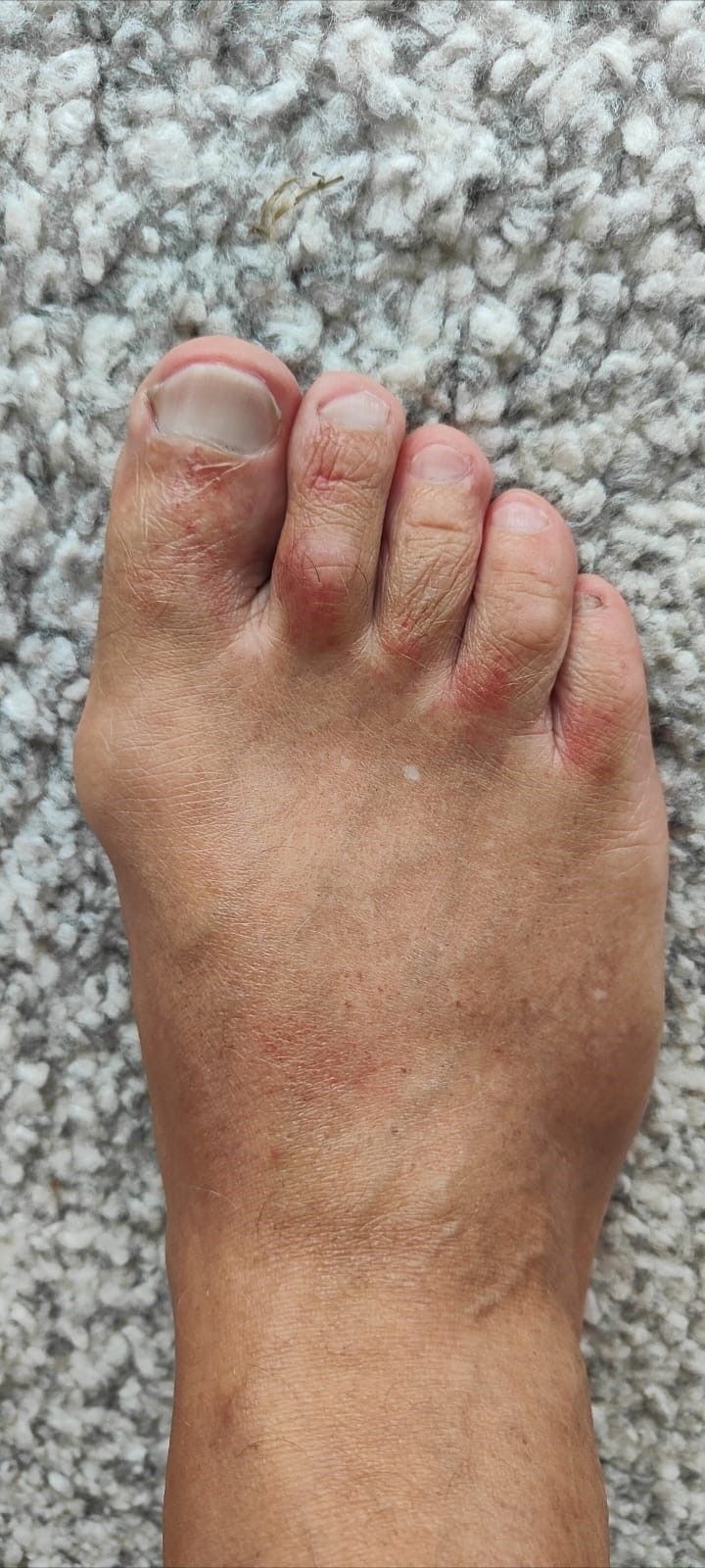 Welsbiss Gerri Hämmerle