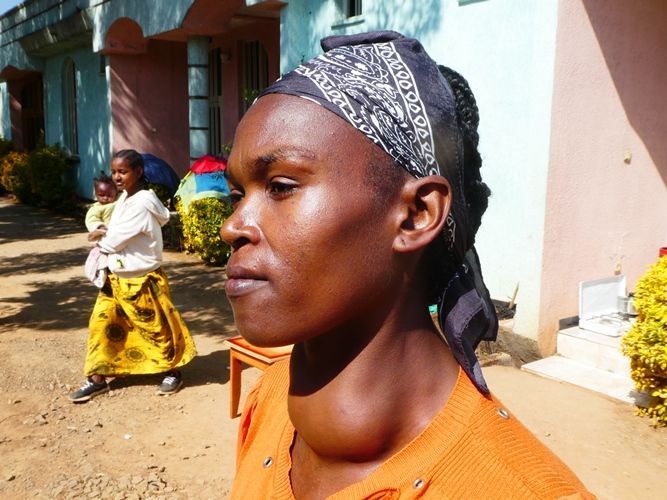 In Äthiopien sind 35 Millionen Menschen von der Schilddrüsenerkrankung Struma betroffen. HW