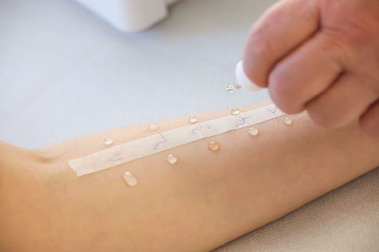 Pollenallergien nehmen zu: So schützen Sie sich