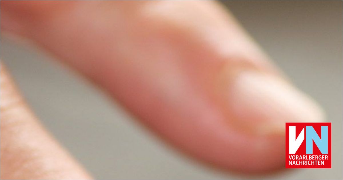 Die Finger bei Arbeitsunfall eingeklemmt Vorarlberger Nachrichten VN.at